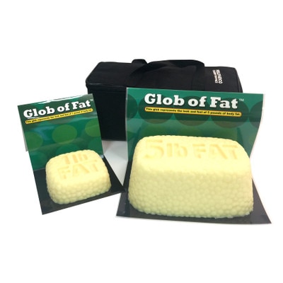 Globs of Fat Set, 1-pound and 5-pound by Health Edco for health education, realistic and squishy body fat models, 26031