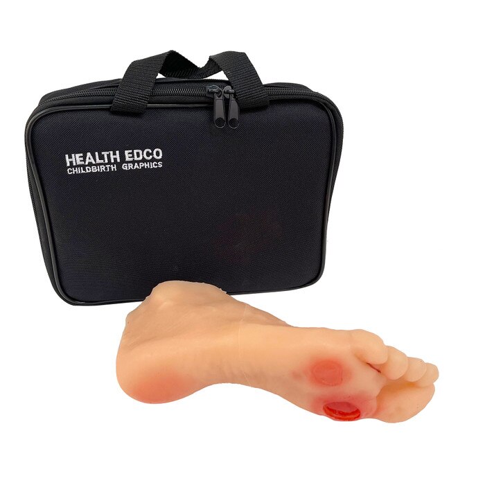 Diabetic Foot Model with case, lifelike health education model showing diabetic foot damage and ulcers, Health Edco, 26101