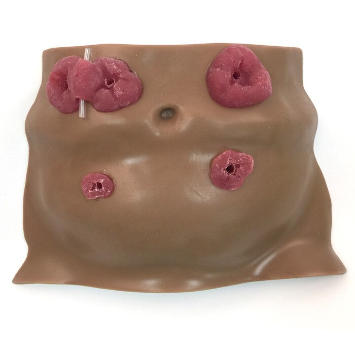 Ostomy Care Model, Brown, for health education and training, brown lifelike torso model with four stomas, Health Edco 26132
