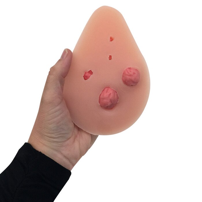 interchangeable nodules breast self-examination model, multiple sized breast lumps, realistic, palpable synthetic tissue, back view of nodules in place, Health Edco, 26504