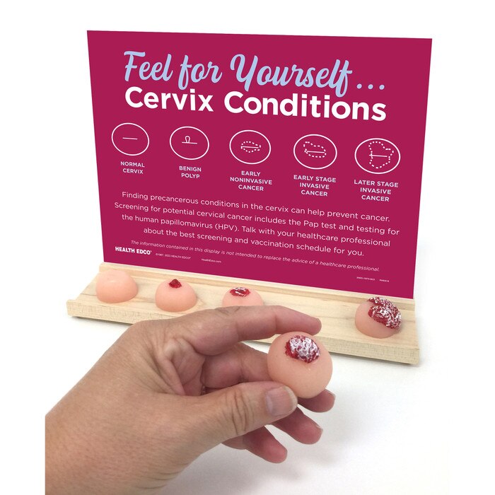 Feel for Yourself: Cervix Conditions Display for health education by Health Edco with models of cervical conditions, 26805