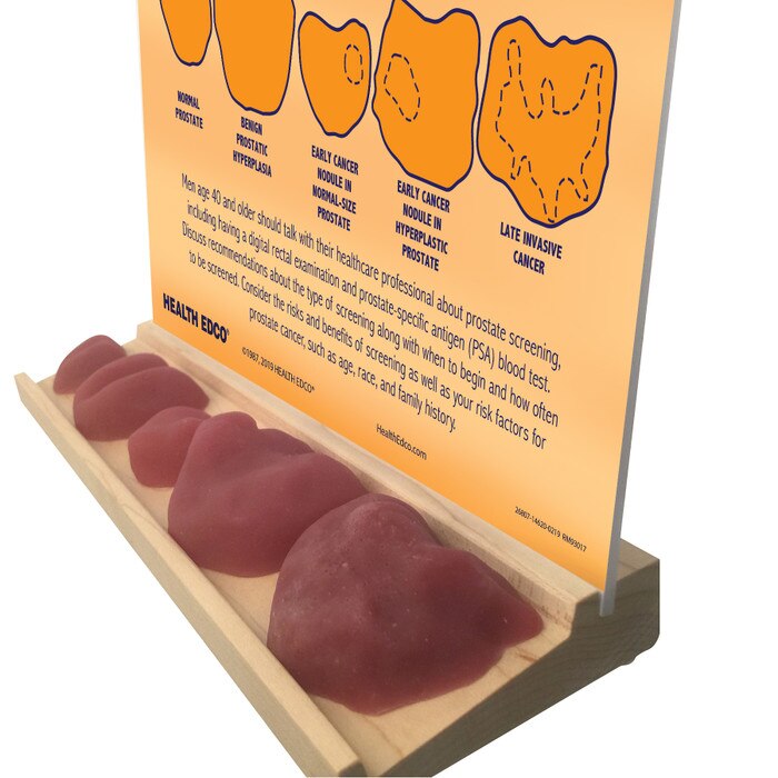 Feel for Yourself: Prostate Conditions Display for mens health education from Health Edco side view of prostate models, 26807