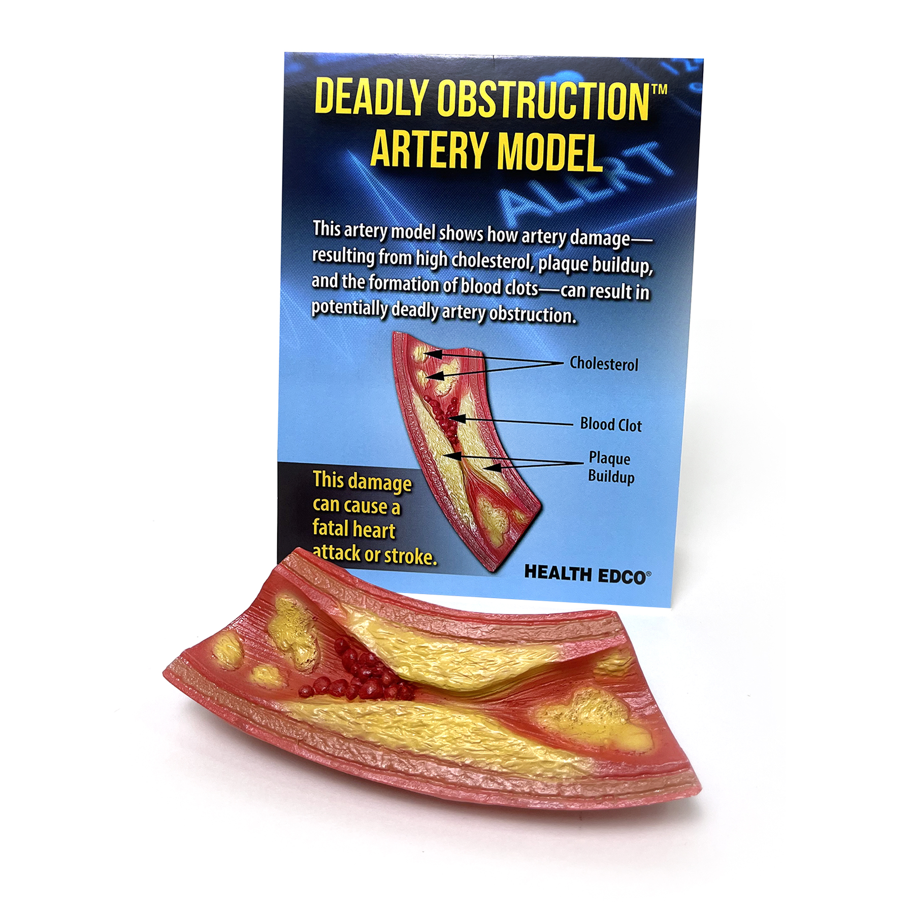 Deadly Obstruction Artery Model