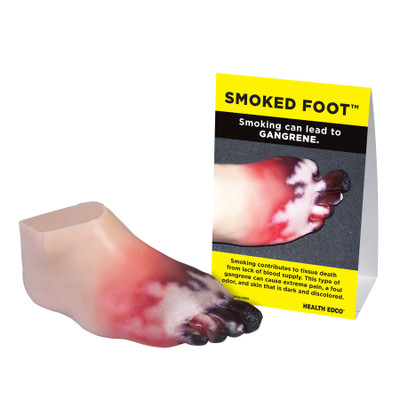 Gangrene Foot Model, smoking foot tissue damage, realistic foot model depicting gangrene with tent card, Health Edco, 27029