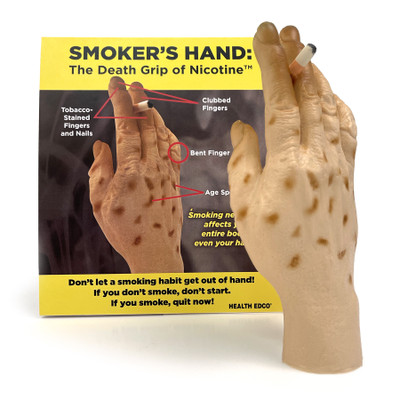 Smoker's Hand: The Death Grip of Nicotine Model, health education tobacco teaching tool with tent card, Health Edco, 27034