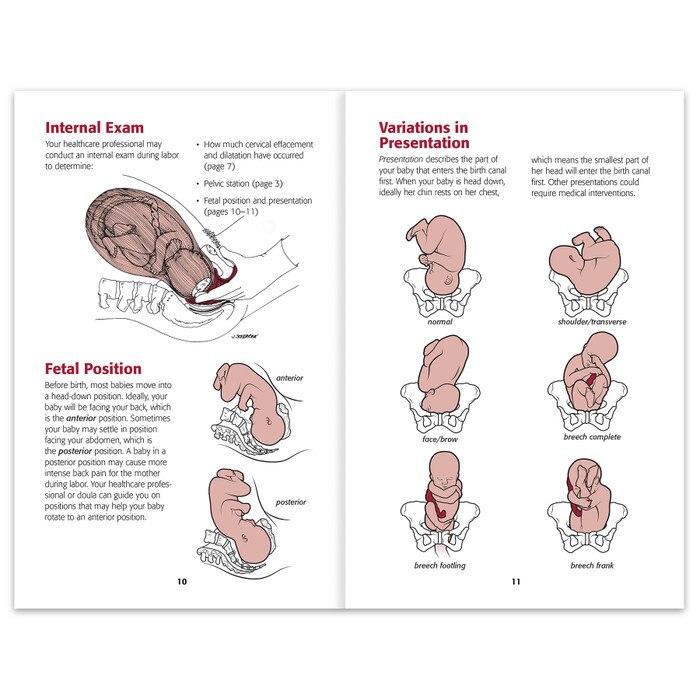 How Will I Know If I'm in Labor Booklet from Childbirth Graphics, childbirth education resource for expectant parents, 38534