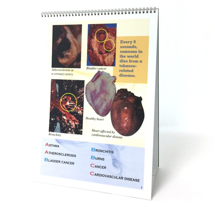 The ABCs of Smoking 6-panel spiral-bound flip chart English version photos of organs list of A through C, Health Edco, 43107