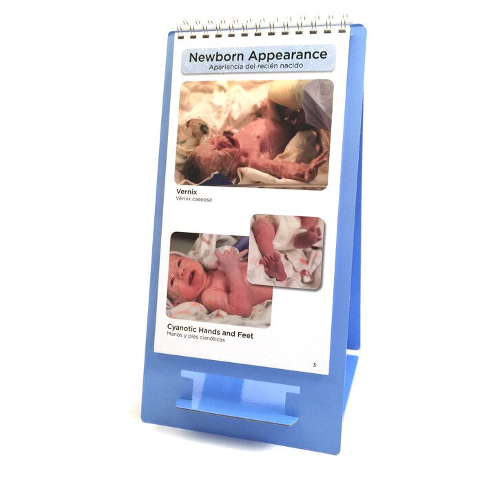 Healthy Newborns Flip Chart for childbirth education by Childbirth Graphics, images of newborn vernix and cyanosis, 43303