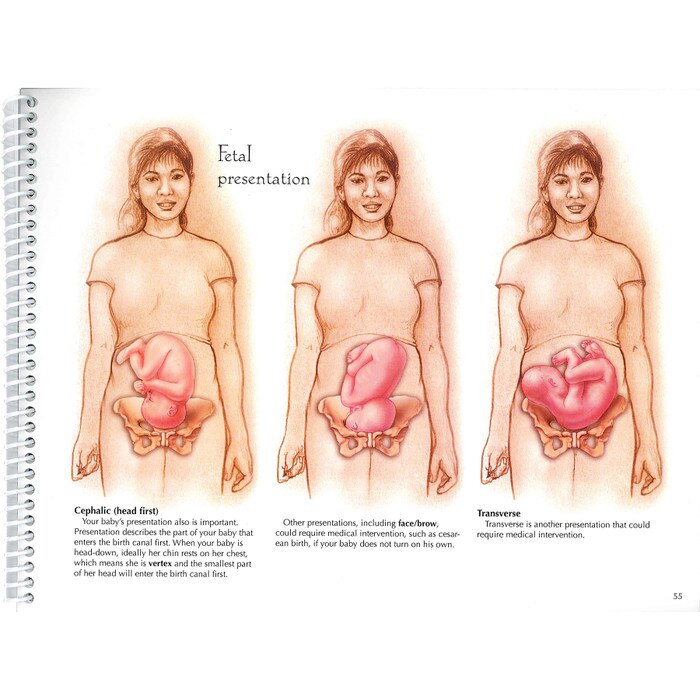 With Child Desk Version spiral bound 78 pages page 55 three female torsos fetal presentation, Childbirth Graphics, 43317