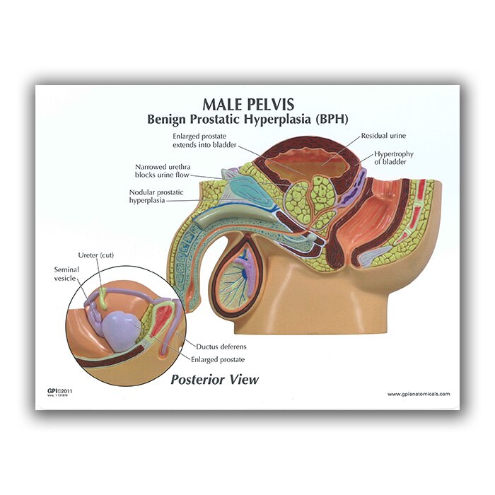 prostate anatomy 3d)