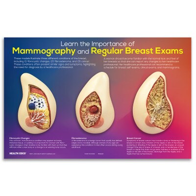 Learn the Importance of Mammography Display, women's breast health education display with breast models, Health Edco, 51200