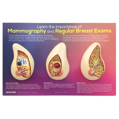 Learn the Importance of Mammography Display, women's breast health education display with breast models, Health Edco, 51200