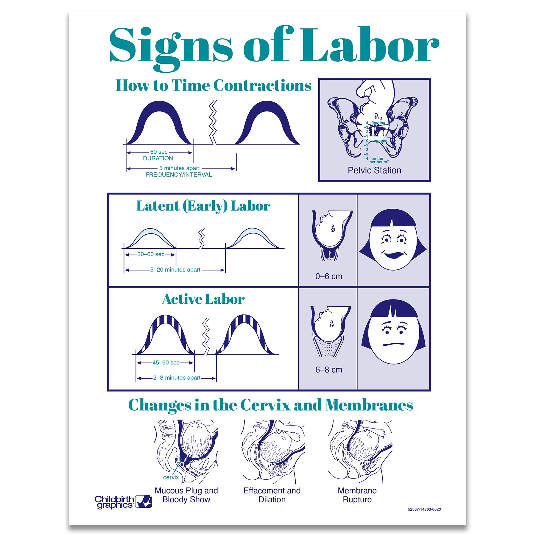 Labor Contractions Chart