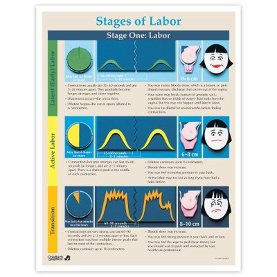 Stages of Labor Tear Pad for childbirth education from Childbirth Graphics with color images the three stages of labor, 52736