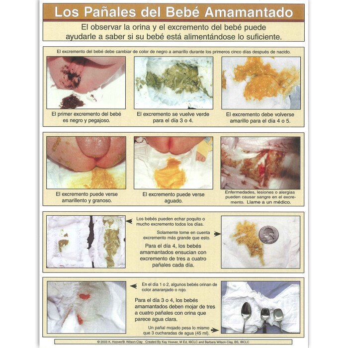 Diapers of the Breastfed Baby full color photo tear pad Spanish, colors of breastfed stool, Childbirth Graphics 52757