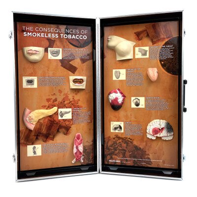 Smokeless Tobacco Consequences 3-D Display, health education display with tobacco diseased organ models, Health Edco, 78817