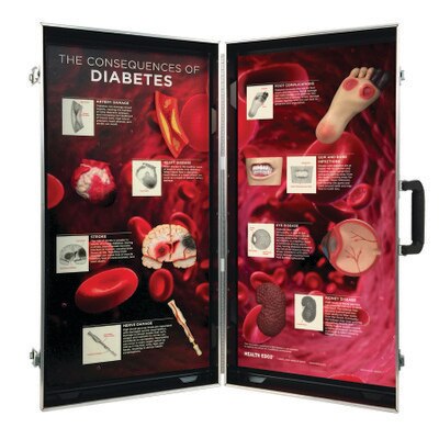 Diabetes Consequences 3-D Display, diabetes education display with body organ models affected by diabetes, Health Edco, 78878