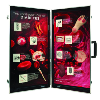 Diabetes Consequences 3-D Display, diabetes education display with body organ models affected by diabetes, Health Edco, 78878