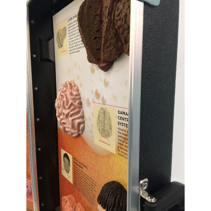 Alcohol Abuse Consequences 3-D Display, health education display, close-up of scultped painted models, Health Edco, 78879