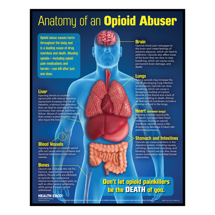 Anatomy of an Opioid Abuser 3-D health education display, opioid drug education materials and models, Health Edco, 78883