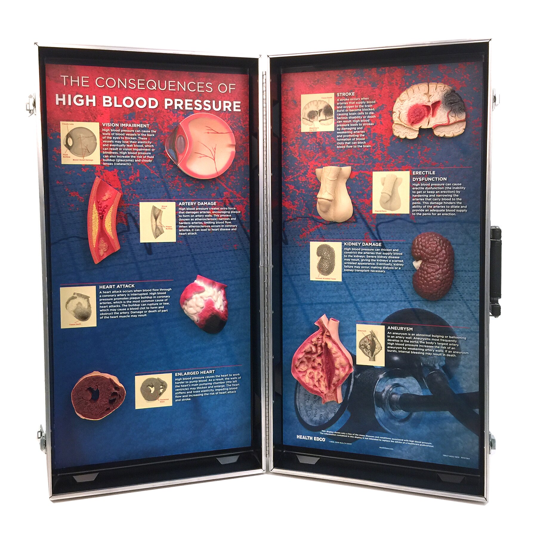 Hypertension Organ Model Set 