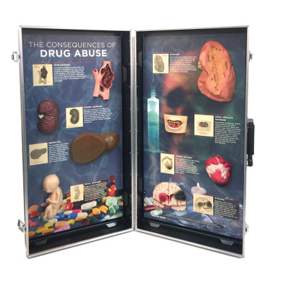 Drug Abuse Consequences 3-D Display from Health Edco with 3-D organ models to depict the health effects of drug abuse, 78928