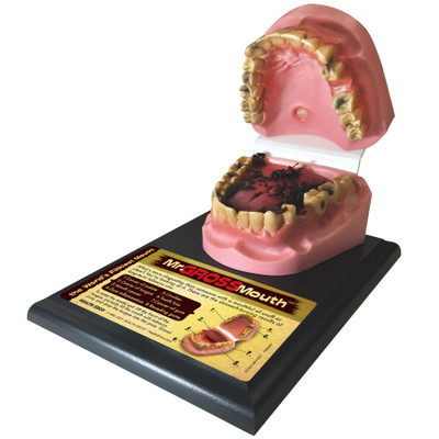 Mr Gross Mouth, Health Edco health education mouth model showing gross, damaging health effects of smokeless tobacco, 79152