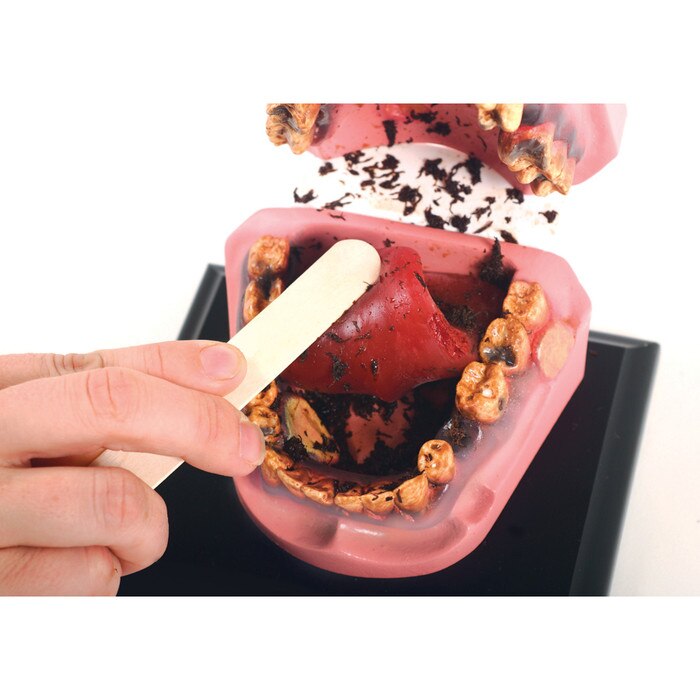 Mr Gross Mouth, Health Edco health education mouth model showing gross, damaging health effects of smokeless tobacco, 79152