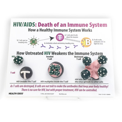 HIV AIDS Death of an Immune System Easel Display for health education with models from Health Edco, 79180