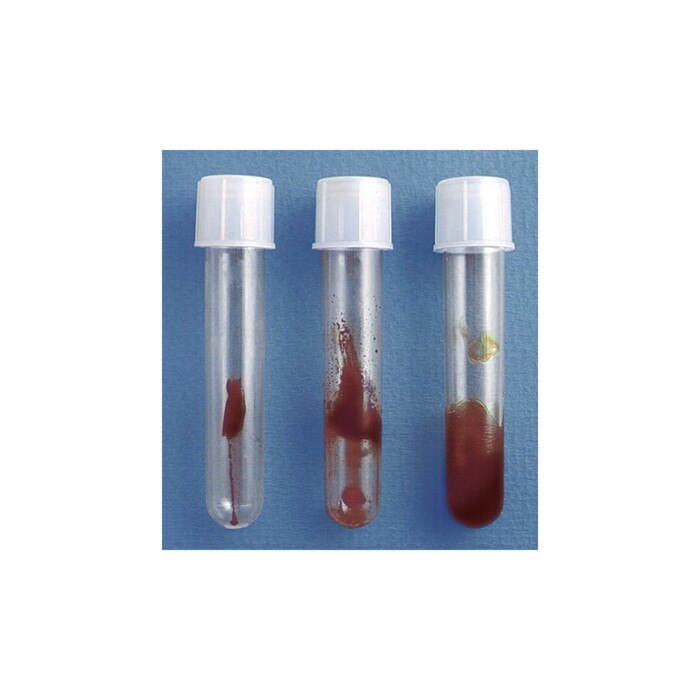 Smokey Sue Display, health education display test tubes to collect cigarette smoke tar for visualization, Health Edco, 79206