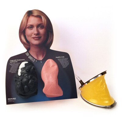 Lou-Wheeze Smoker's Lung Comparison Model from Health Edco with inflatable healthy lung and lung with cancer and COPD, 79261