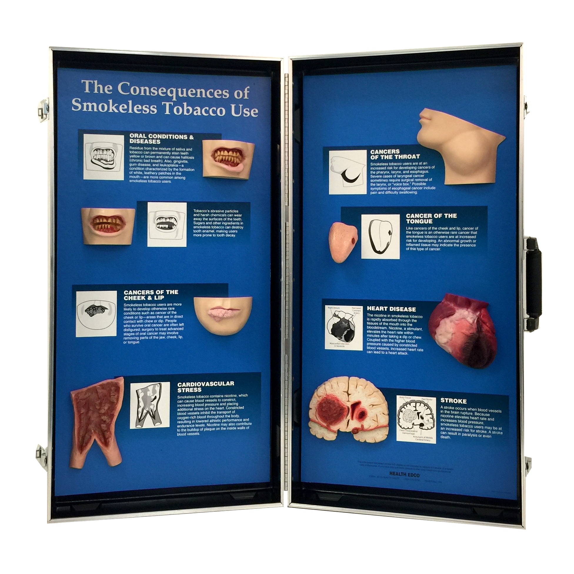 Consequences Of Smokeless Tobacco 3 D Display Health Edco