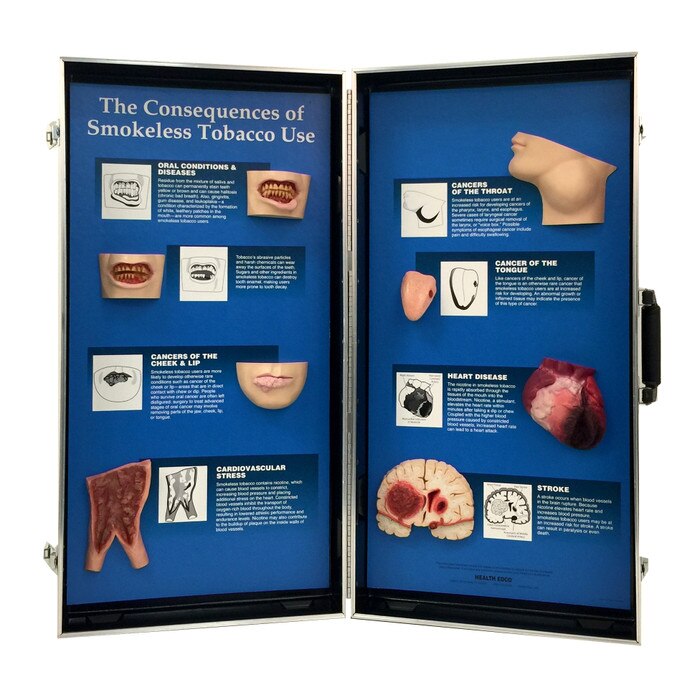 Consequences Of Smokeless Tobacco 3-D Display | Health Edco