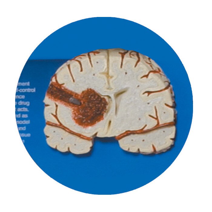 The Consequences Of Drug Abuse 3 D Display Health Edco