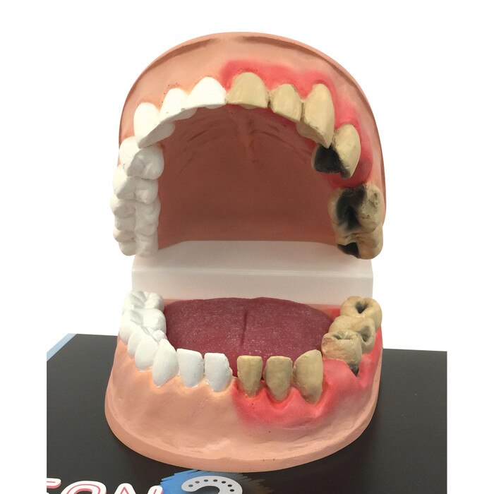 Close up of Dental Health Model from Clean Mouth Dirty Mouth Dental Health Education Display, Health Edco, 79650