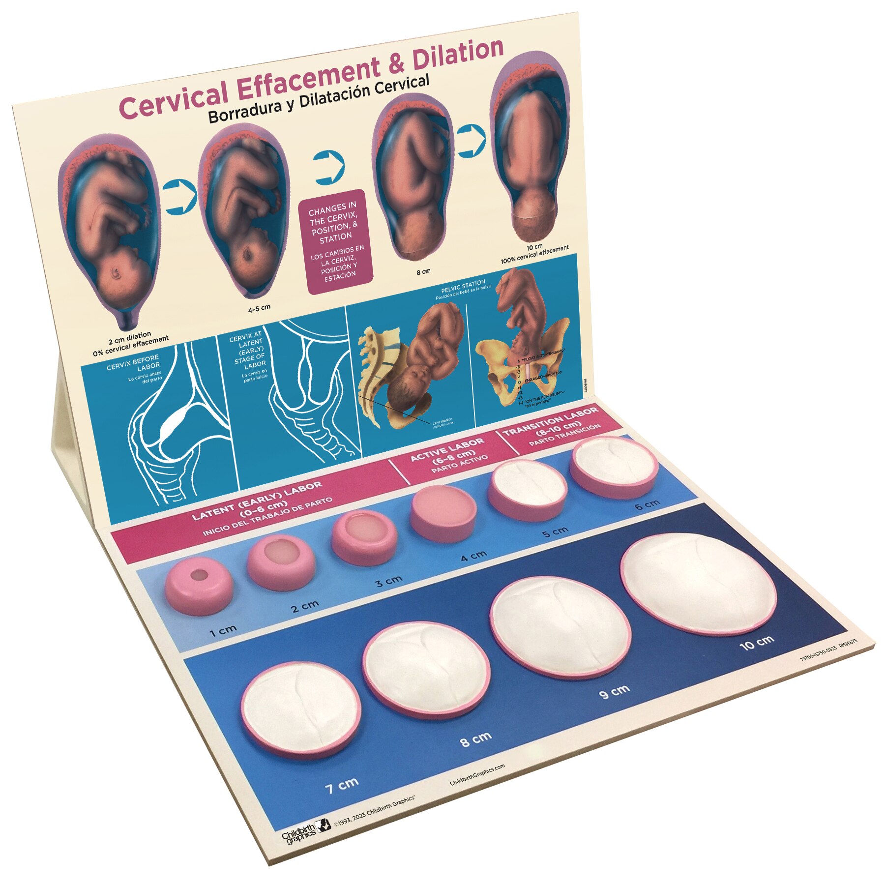 Effacement Chart