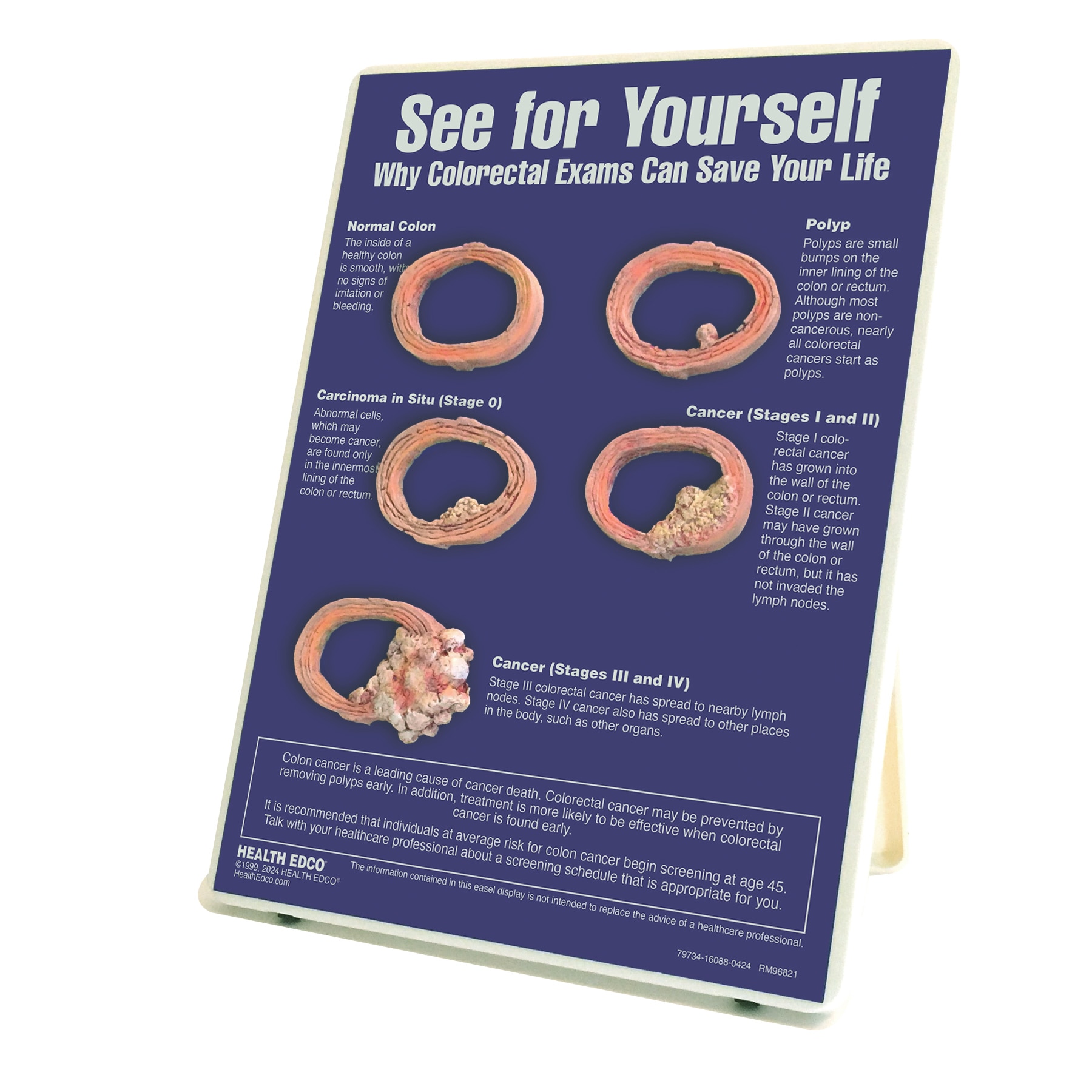 Colorectal Exams Educational Easel Display Health Edco