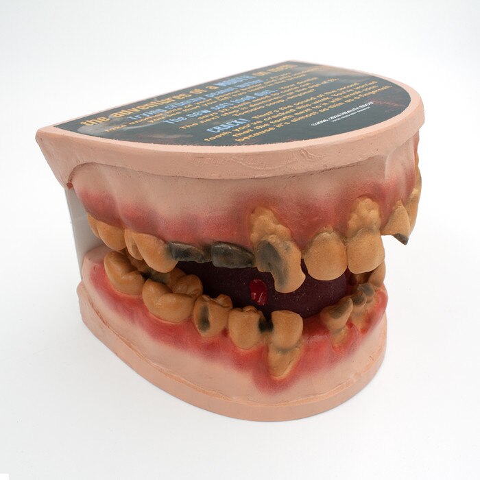 Meth Mouth: An Inside Look Display for health education by Health Edco, mouth model showing oral damage of meth abuse, 79758