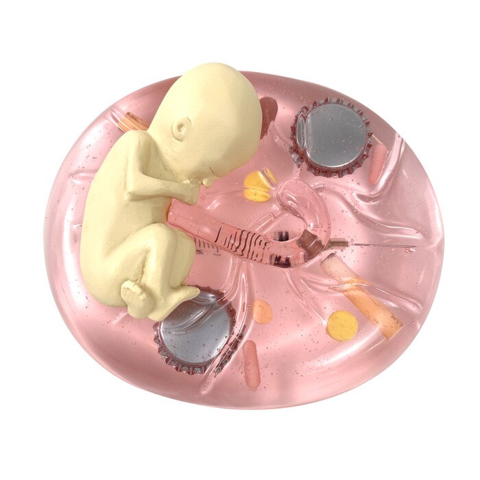 What Mommy Does, Baby Does Model, pregnancy education model showing dangers of substance abuse, Childbirth Graphics, 79809