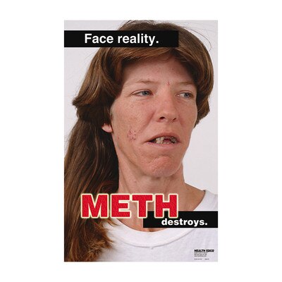 Face Reality Meth Destroys Poster, close-up of woman affected by meth with facial scars & tooth decay-loss, Health Edco, 89168