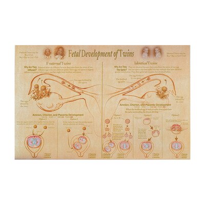 Post Twins Chart, Fetal Development of Twins illustrated fraternal & identical development, Childbifrth Graphics, 89643