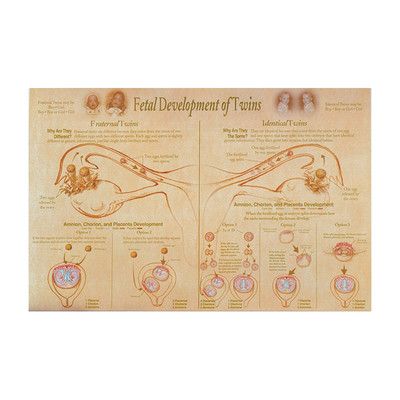 Post Twins Chart, Fetal Development of Twins illustrated fraternal & identical development, Childbifrth Graphics, 89643