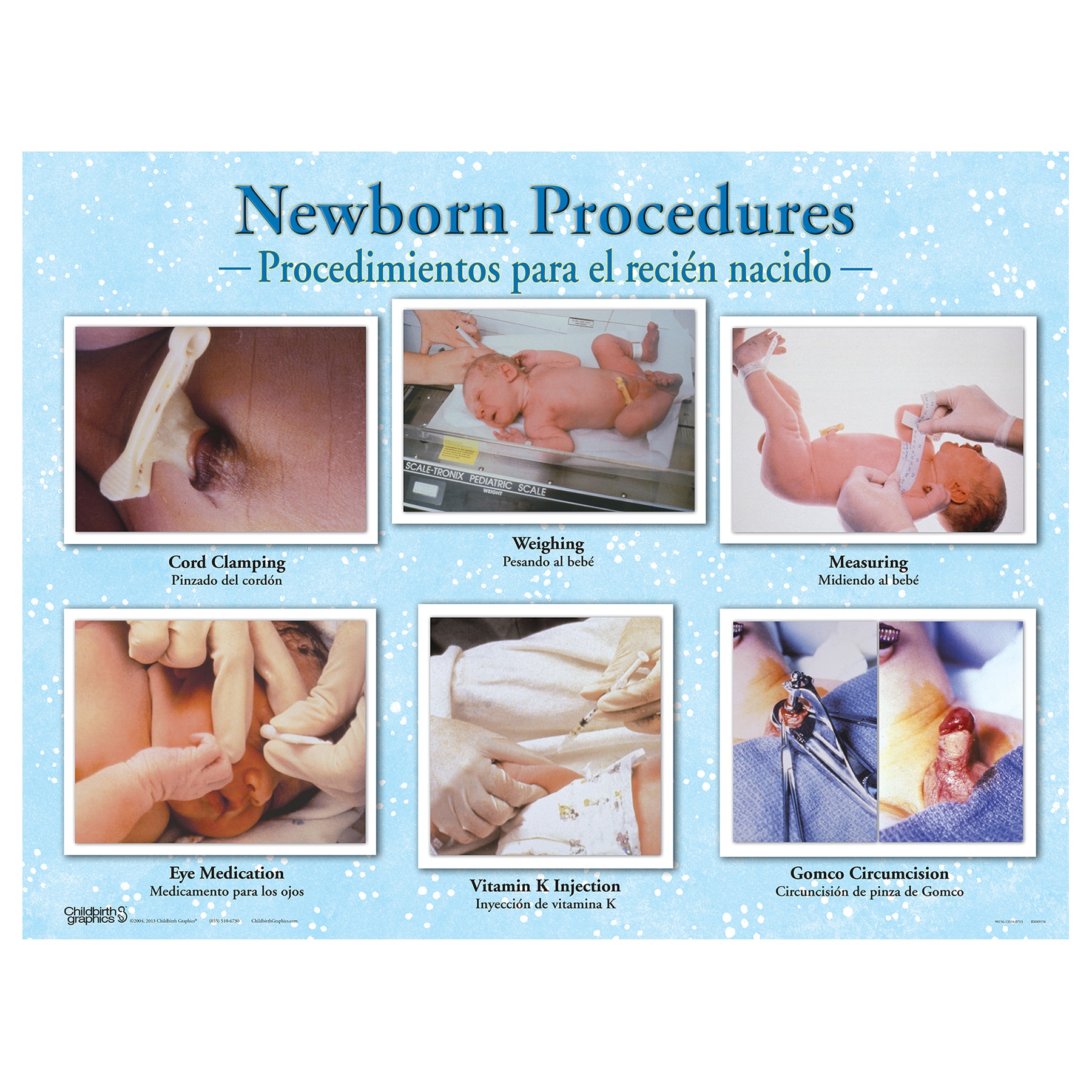 baby-circumcision-healing-pictures