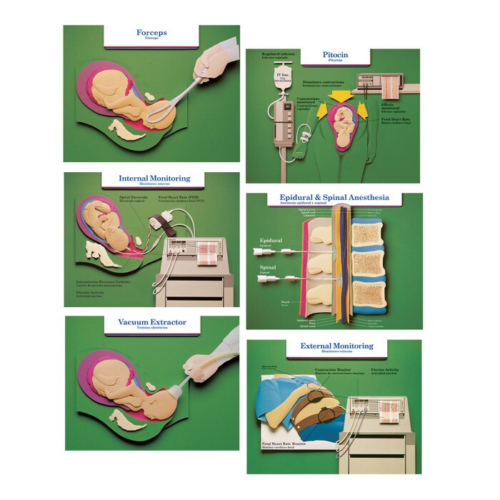 Labor and Birth Intervention Chart Set, six childbirth education charts with a paper art 3D look, Childbirth Graphics, 90615