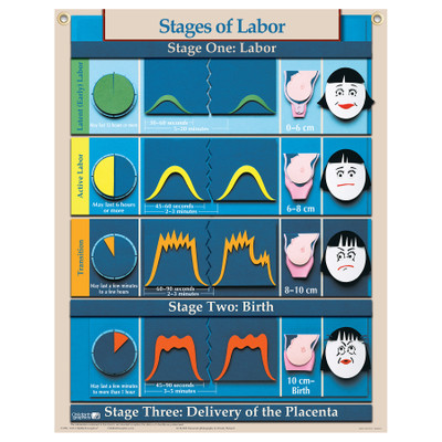 Stages of Labor Chart for childbirth education from Childbirth Graphics, English text with pictorial illustrations, 90620