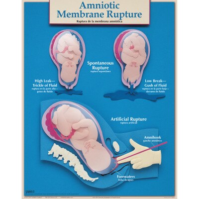 Six Essential Labor Birth Charts Childbirth Graphics