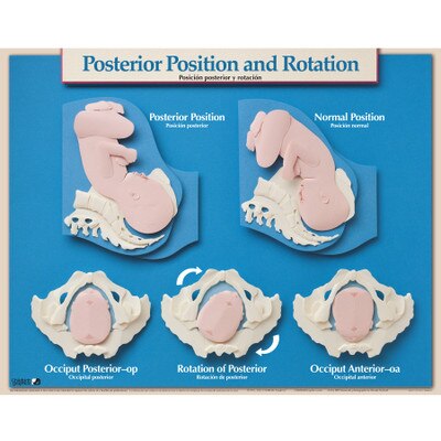 Six Essential Labor Birth Charts Childbirth Graphics