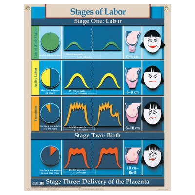 Six Essential Labor Birth Charts Childbirth Graphics