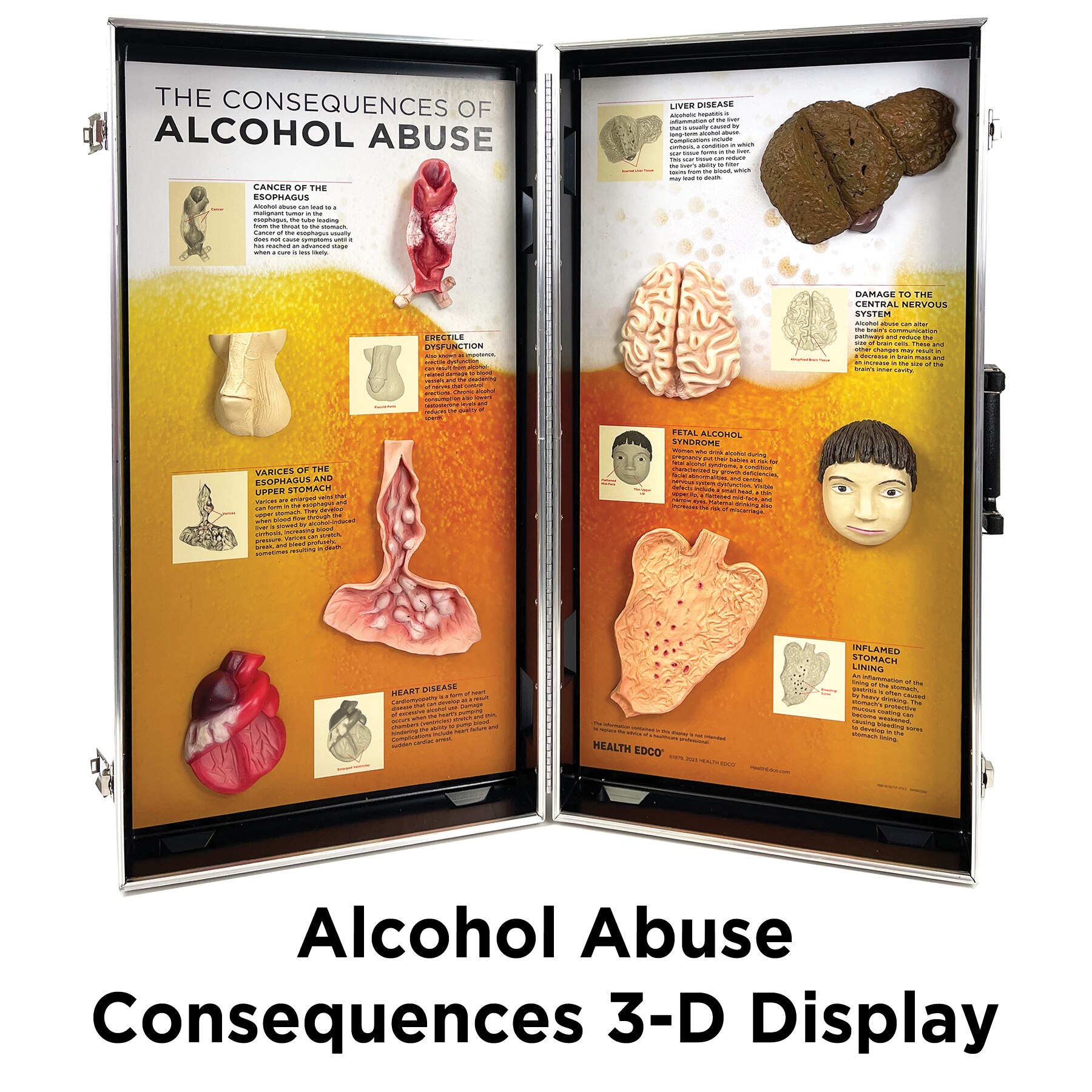 Alcohol Abuse Consequences 3-D Display, health education display of physical effects of alcohol abuse, Health Edco, 78879