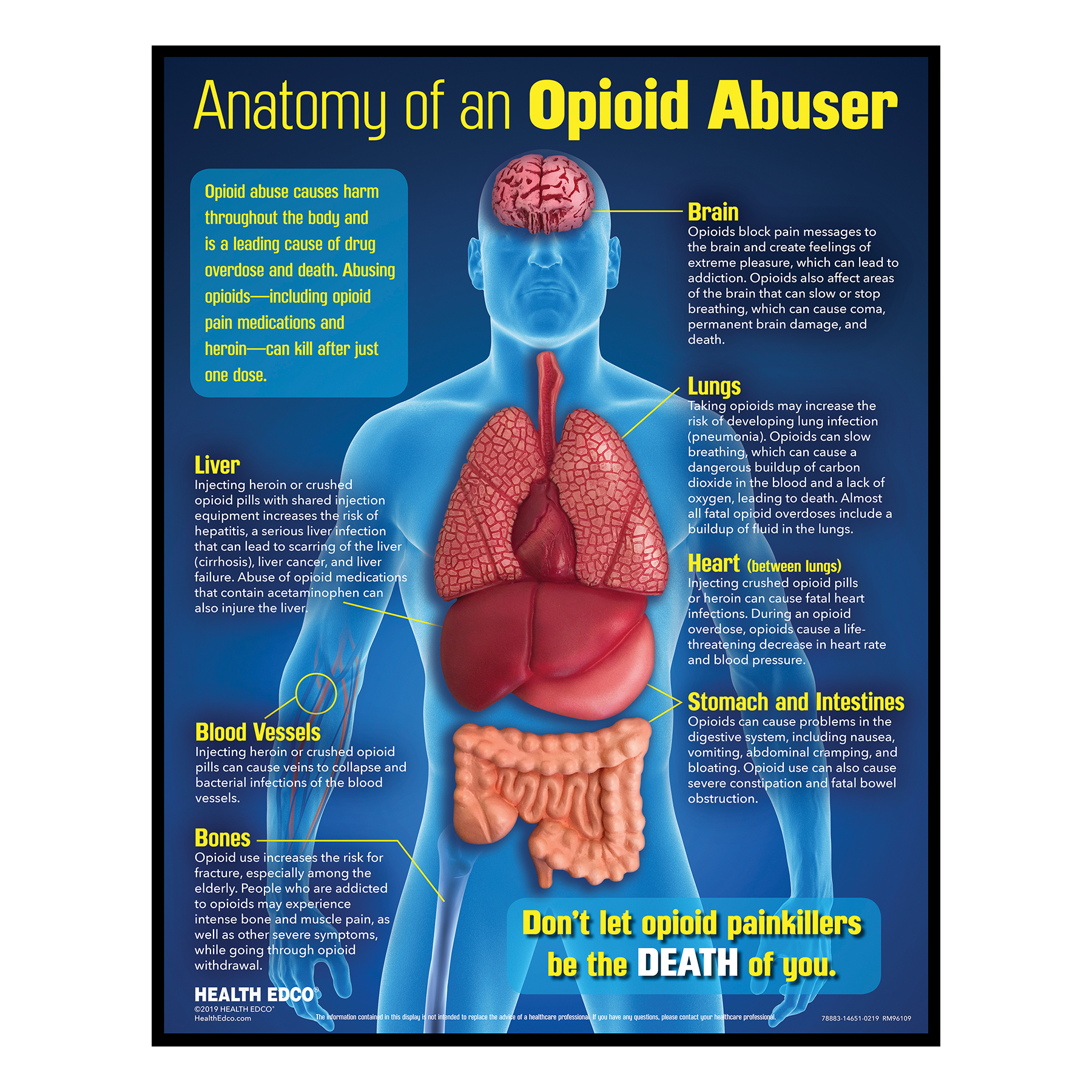 Anatomy of an Opioid Abuser Drug Education Display with 3-D Models